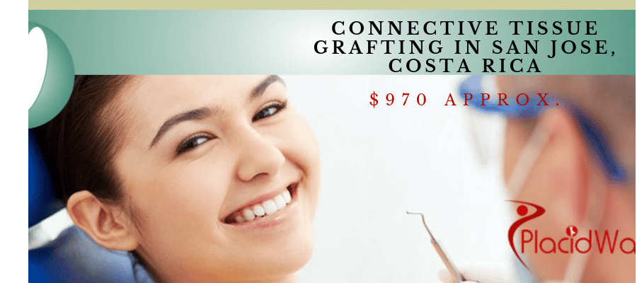 Connective Tissue Grafting in San Jose, Costa Rica Cost